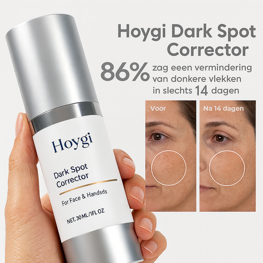 Hoygi Dark Spot Corrector | Feel Beautiful in Your Own Skin Again